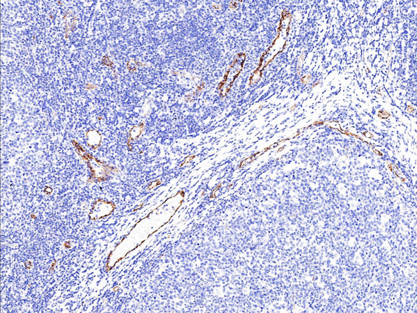 Recombinant vWF Monoclonal Antibody (AGEL5398)