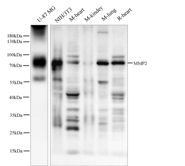 Recombinant MMP-2 Monoclonal Antibody (AGEL5402)