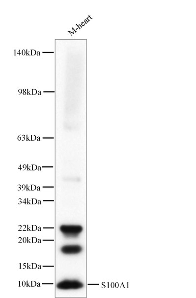 Recombinant S100A1 Monoclonal Antibody (AGEL5403)