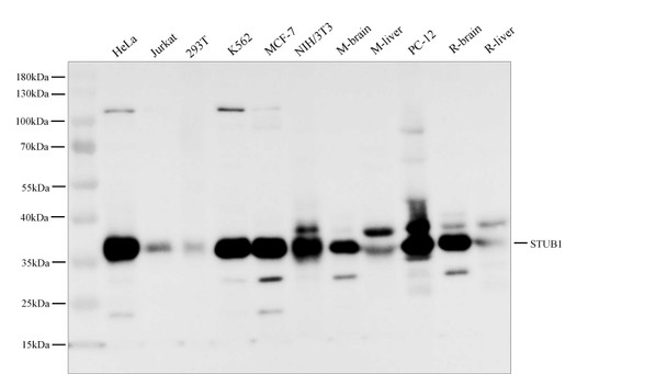 Recombinant STUB1 Monoclonal Antibody (AGEL5404)