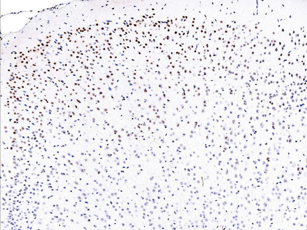 Recombinant Phospho-CREB (Ser133) Monoclonal Antibody (AGEL5406)