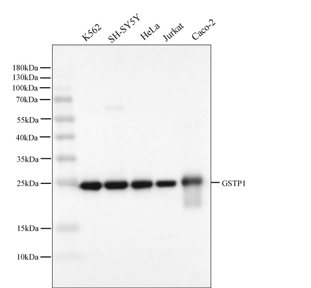 Recombinant GSTP1 Monoclonal Antibody (AGEL5408)