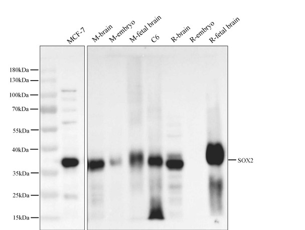 Recombinant Sox2 Monoclonal Antibody (AGEL5413)