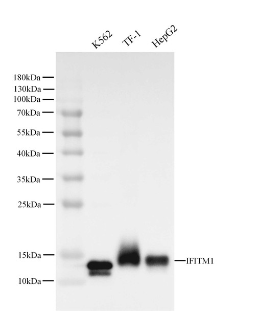 Recombinant IFITM1 Monoclonal Antibody (AGEL5438)