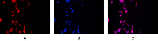 Recombinant CD14 Monoclonal Antibody (AGEL5441)