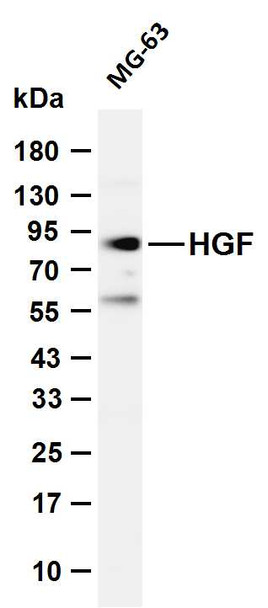 Recombinant HGF Monoclonal Antibody (AGEL5447)