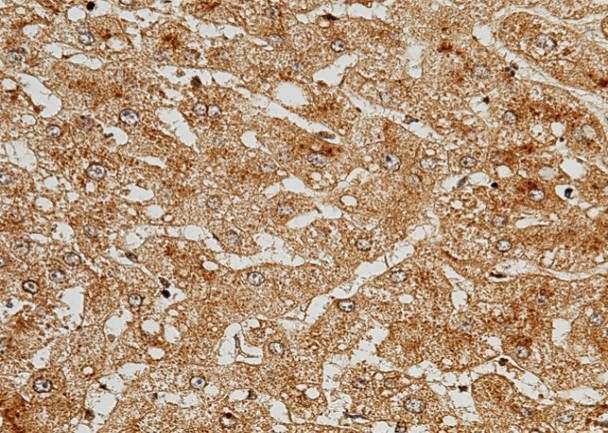 Recombinant C5a/Complement 5a Monoclonal Antibody (AGEL5453)