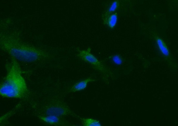 Recombinant Tie2/CD202b/TEK Monoclonal Antibody (AGEL5455)