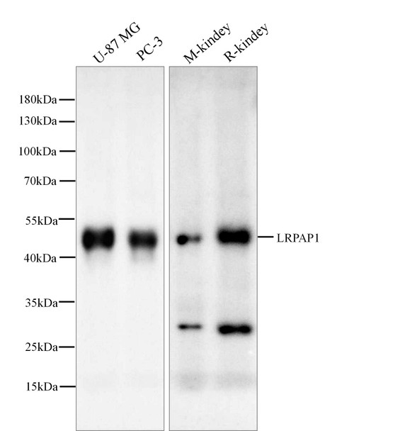 Recombinant LRPAP1/A2MRAP Monoclonal Antibody (AGEL5467)