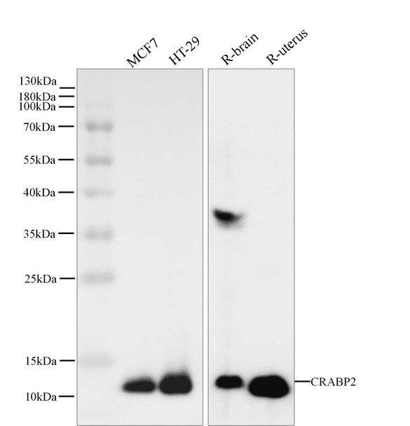 Recombinant CRABP2 Monoclonal Antibody (AGEL5471)