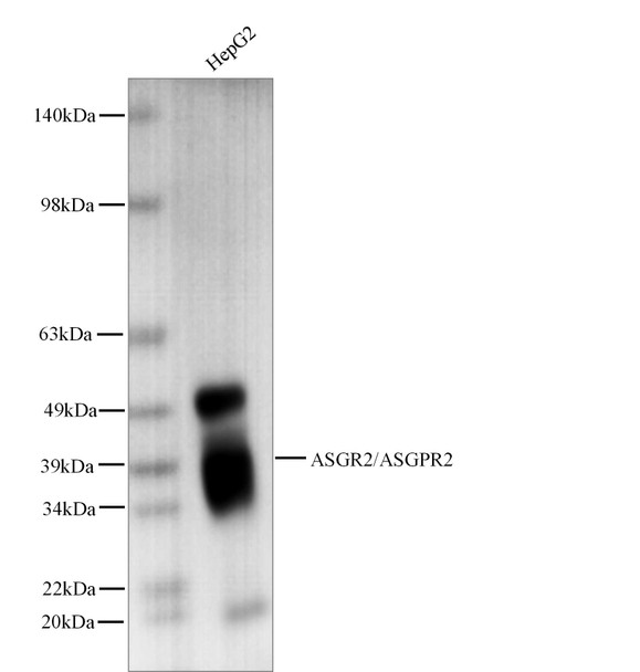 Recombinant ASGR2/ASGPR2 Monoclonal Antibody (AGEL5489)