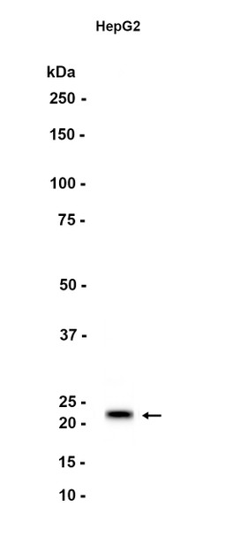 Recombinant RBP4 Monoclonal Antibody (AGEL5520)