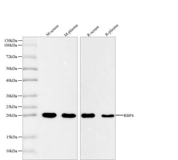 Recombinant RBP4 Monoclonal Antibody (AGEL5521)