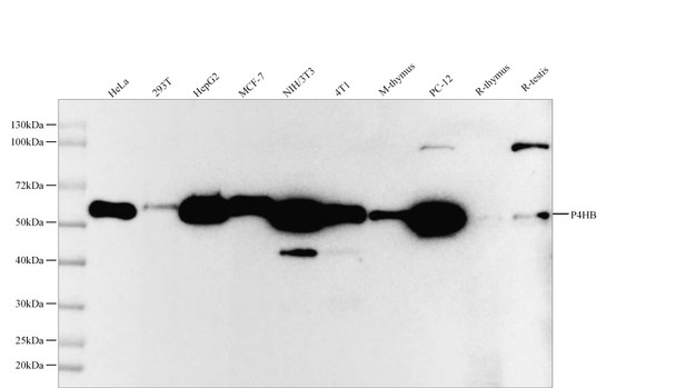 Recombinant P4HB Monoclonal Antibody (AGEL5530)
