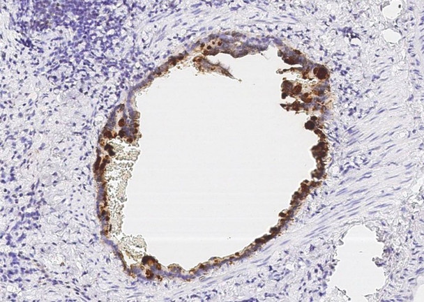 Recombinant HE4/WFDC2/WAP5 Monoclonal Antibody (AGEL5536)