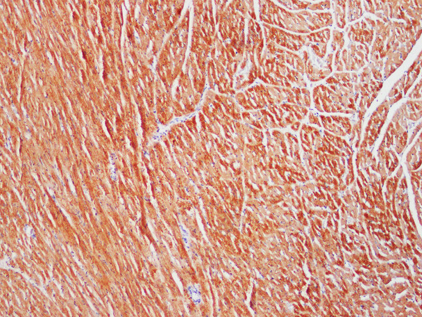 Recombinant Actinin-α2 Monoclonal Antibody (AGEL5539)