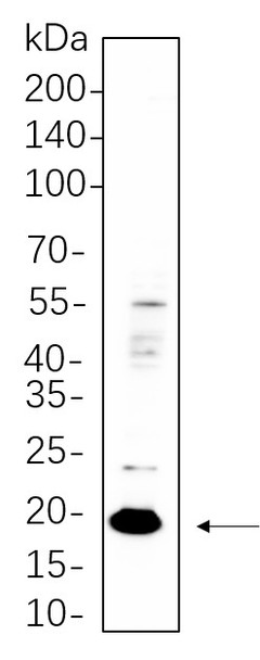Recombinant Claudin 3 Monoclonal Antibody (AGEL5545)