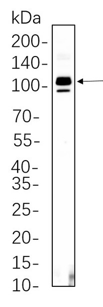 Recombinant SATB2 Monoclonal Antibody (AGEL5547)