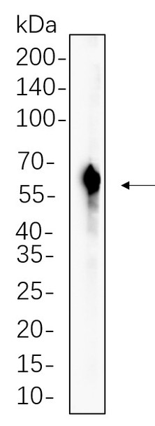 Recombinant RAGE Monoclonal Antibody (AGEL5548)