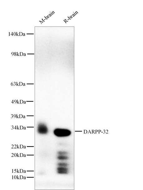 Recombinant DARPP-32 Monoclonal Antibody (AGEL5564)