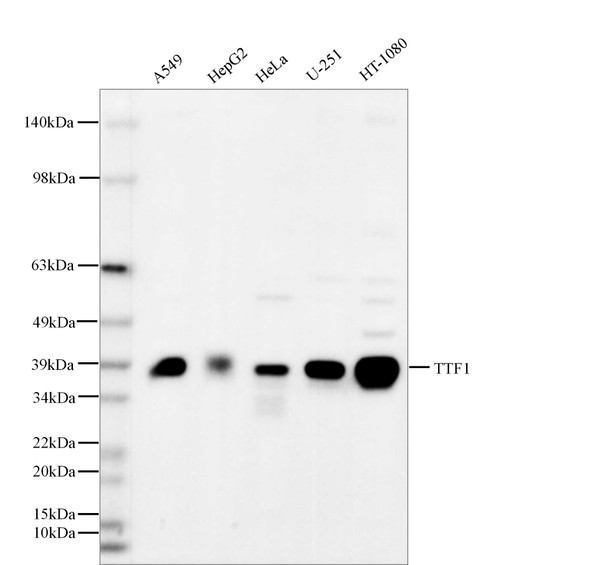 Recombinant TTF1 Monoclonal Antibody (AGEL5590)