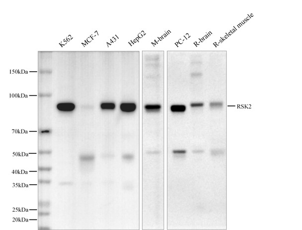 Recombinant RSK2 Monoclonal Antibody (AGEL5594)