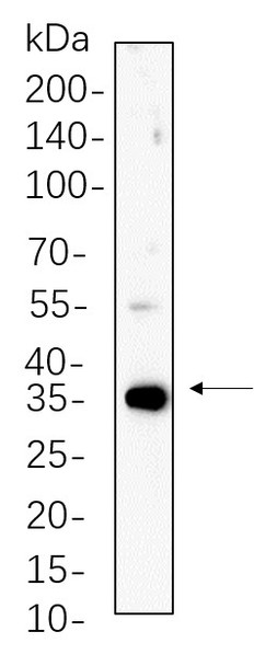 Recombinant PP1α/β Monoclonal Antibody (AGEL5608)