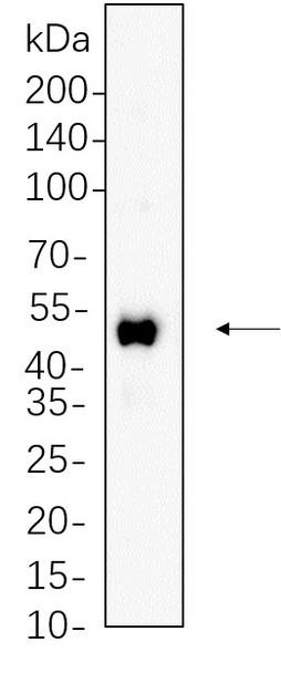 Recombinant RUNX1 Monoclonal Antibody (AGEL5632)