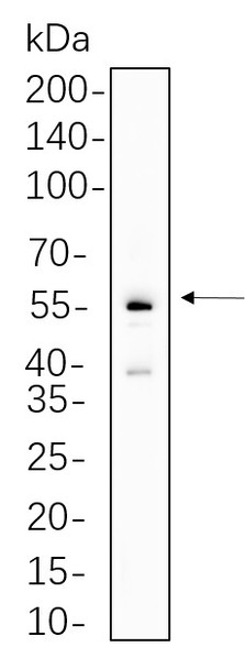 Recombinant Parkin Monoclonal Antibody (AGEL5637)