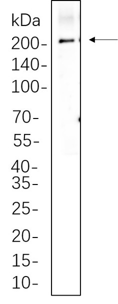 Recombinant LRP6 Monoclonal Antibody (AGEL5662)