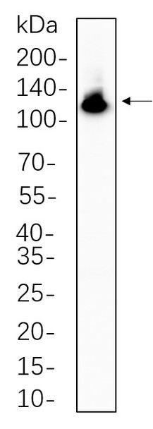 Recombinant NFkB-p100 Monoclonal Antibody (AGEL5665)
