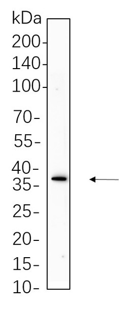 Recombinant Podoplanin Monoclonal Antibody (AGEL5680)