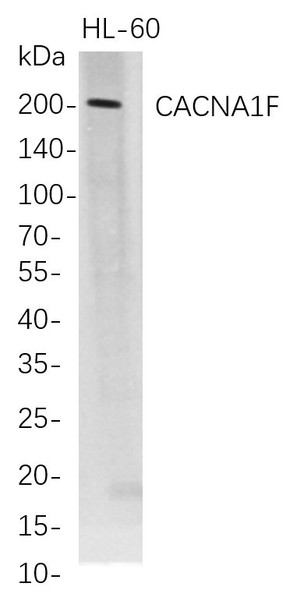 Recombinant CACNA1F Monoclonal Antibody (AGEL5685)