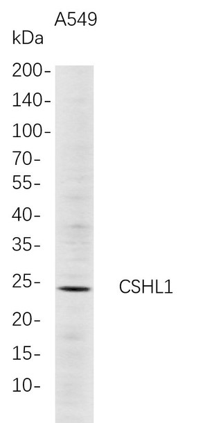 Recombinant CSHL1 Monoclonal Antibody (AGEL5692)