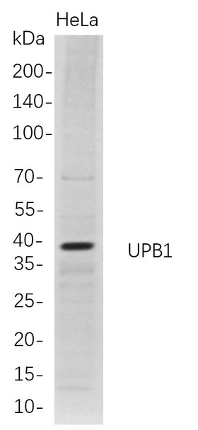 Recombinant UPB1 Monoclonal Antibody (AGEL5714)