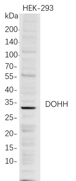 Recombinant DOHH Monoclonal Antibody (AGEL5726)