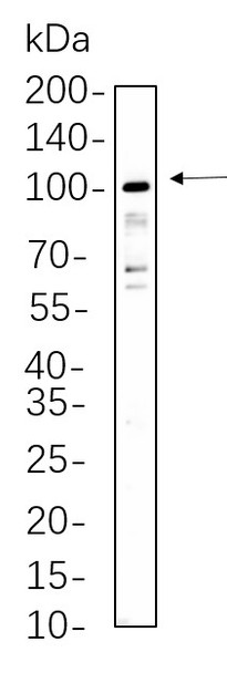 Recombinant STAT5A/B Monoclonal Antibody (AGEL5757)