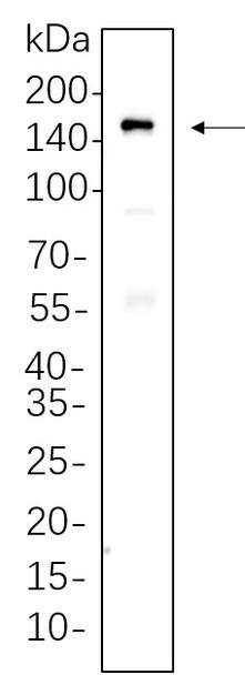 Recombinant MDR1 Monoclonal Antibody (AGEL5760)