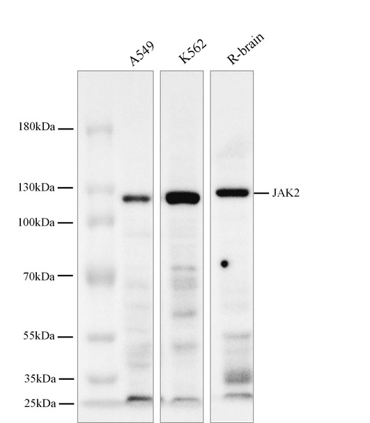 Recombinant JAK2 Monoclonal Antibody (AGEL5794)