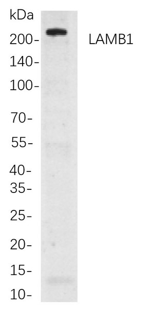 Recombinant LAMB1 Monoclonal Antibody (AGEL5821)