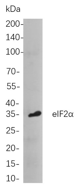 Recombinant eIF2α Monoclonal Antibody (AGEL5822)
