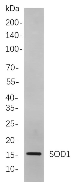 Recombinant SOD1 Monoclonal Antibody (AGEL5827)