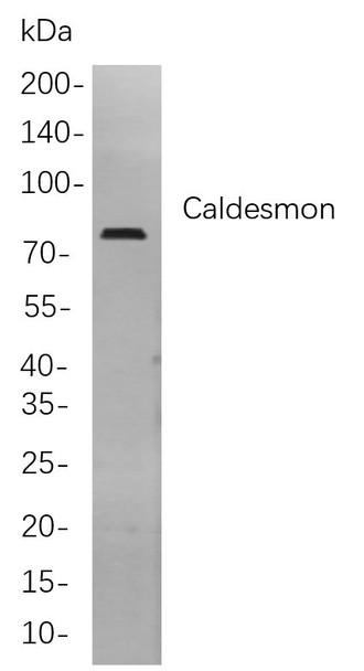 Recombinant Caldesmon Monoclonal Antibody (AGEL5831)