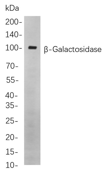 Recombinant β-Galactosidase Monoclonal Antibody (AGEL5843)