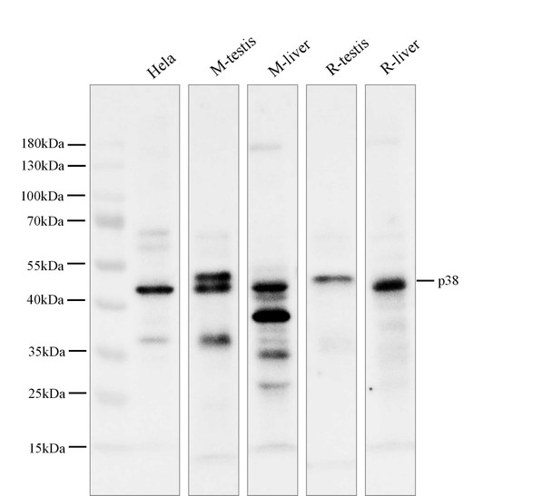 Recombinant p38 Monoclonal Antibody (AGEL5863)