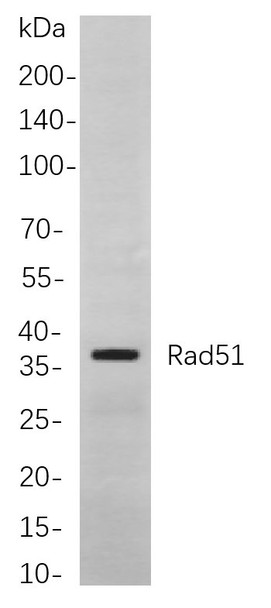 Recombinant Rad51 Monoclonal Antibody (AGEL5870)