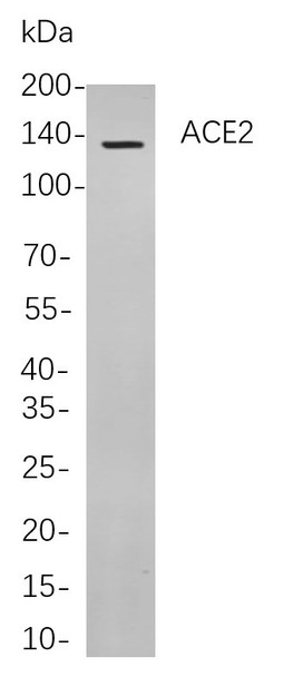 Recombinant ACE2 Monoclonal Antibody (AGEL5871)