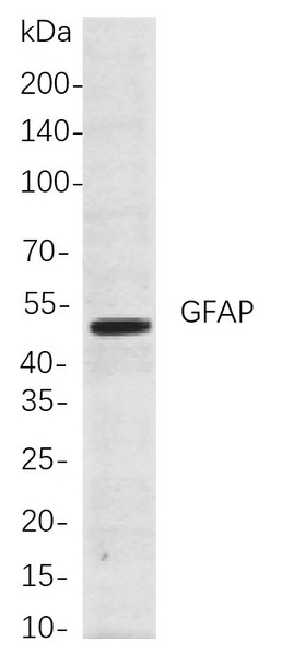 Recombinant GFAP Monoclonal Antibody (AGEL5913)