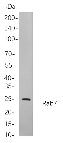 Recombinant Rab7 Monoclonal Antibody (AGEL5917)