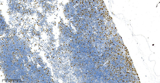 Recombinant PCNA Monoclonal Antibody (AGEL5932)